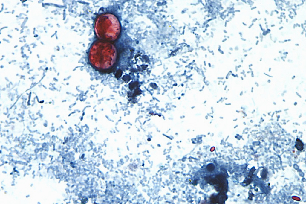 Cyclospora outbreak followed years of declining FDA foreign inspections